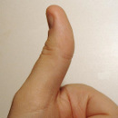 thumb